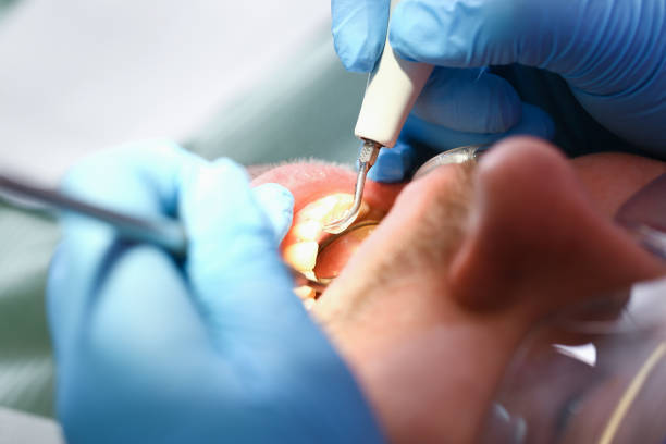Professional Emergency Dental Service in AZ